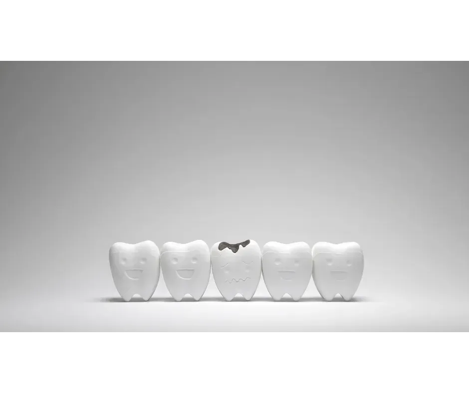 Professional Teeth Whitening at Alta Vista Dental Care